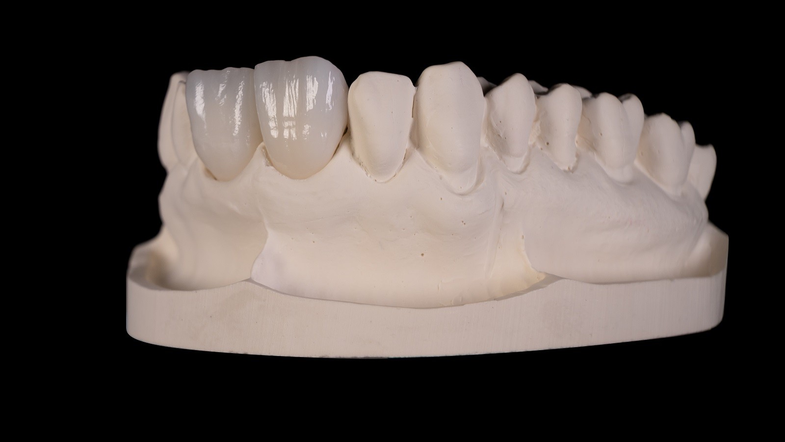 Final result after HeraCeram cre-active 2D Firing