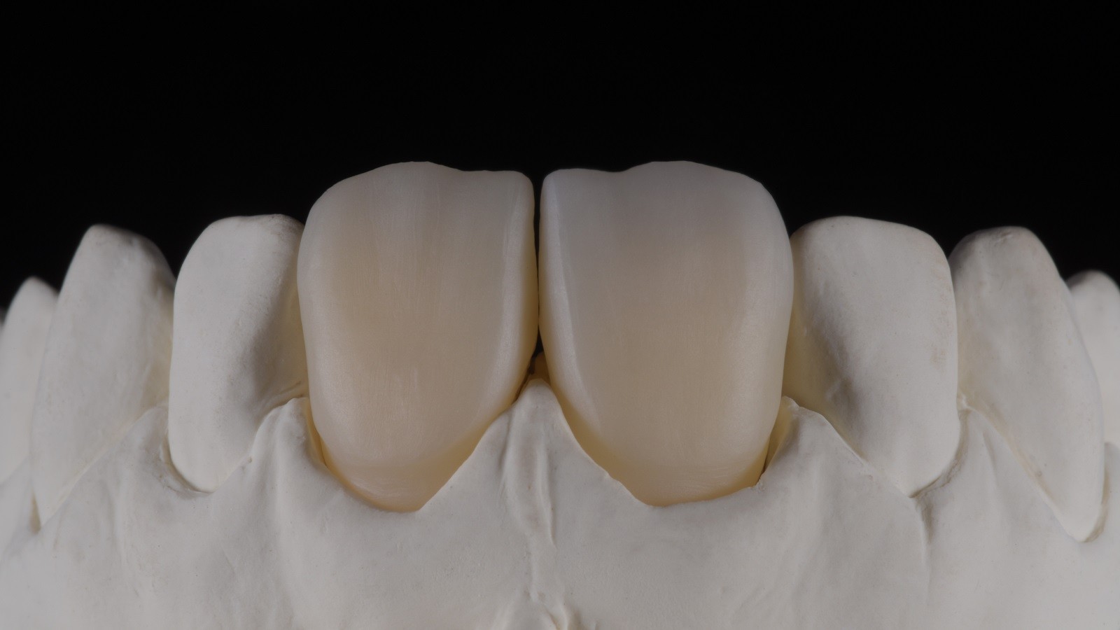 HeraCeram cre-active - take two concept