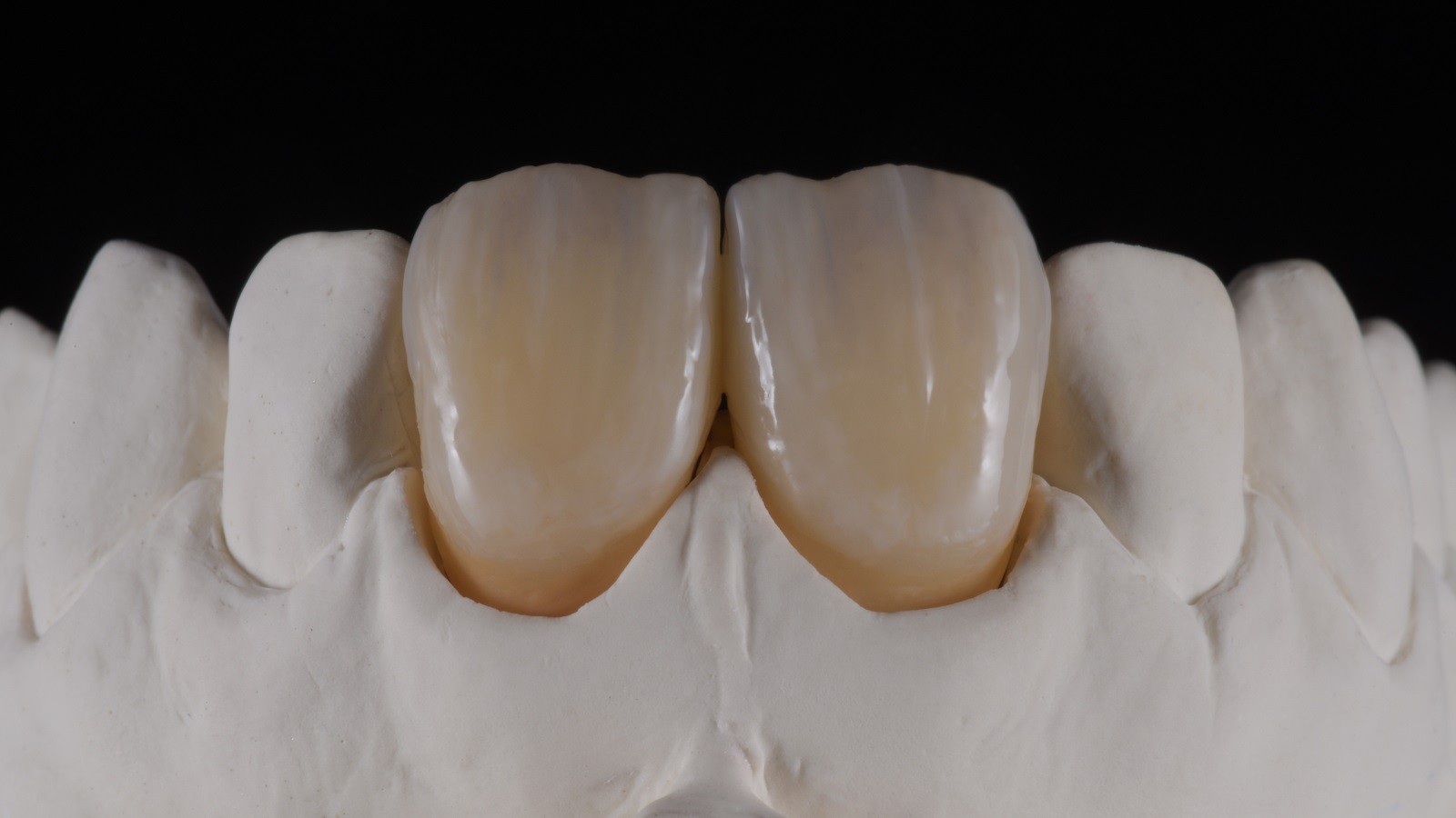 HeraCeram cre-active - take two concept