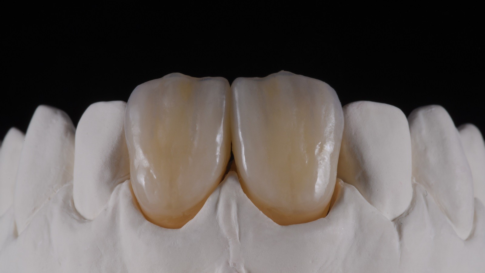 HeraCeram cre-active - take two concept