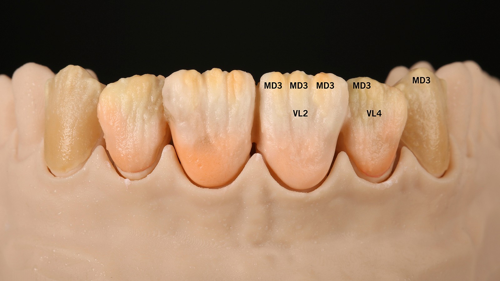 Apply VL 2, VL 4, MD 3