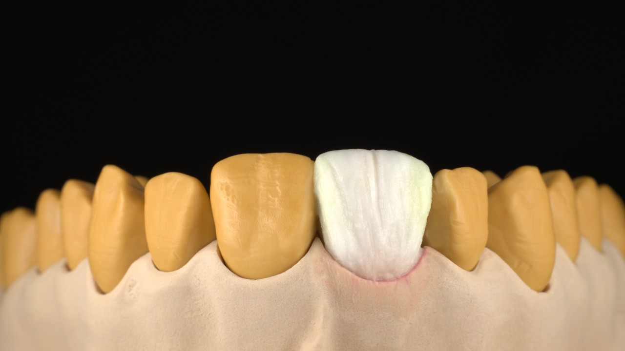 Image 6: Final shaping and shade detailing
